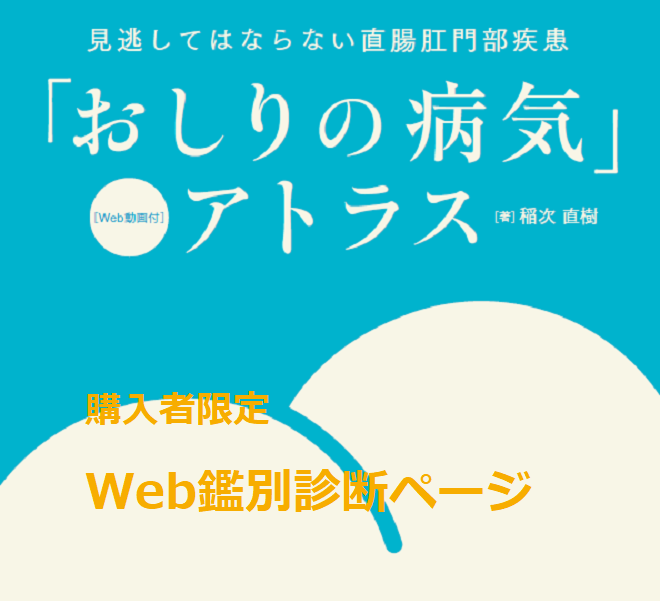 【購入者限定】「おしりの病気」Web鑑別診断