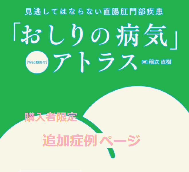 【購入者限定】「おしりの病気」追加・更新情報