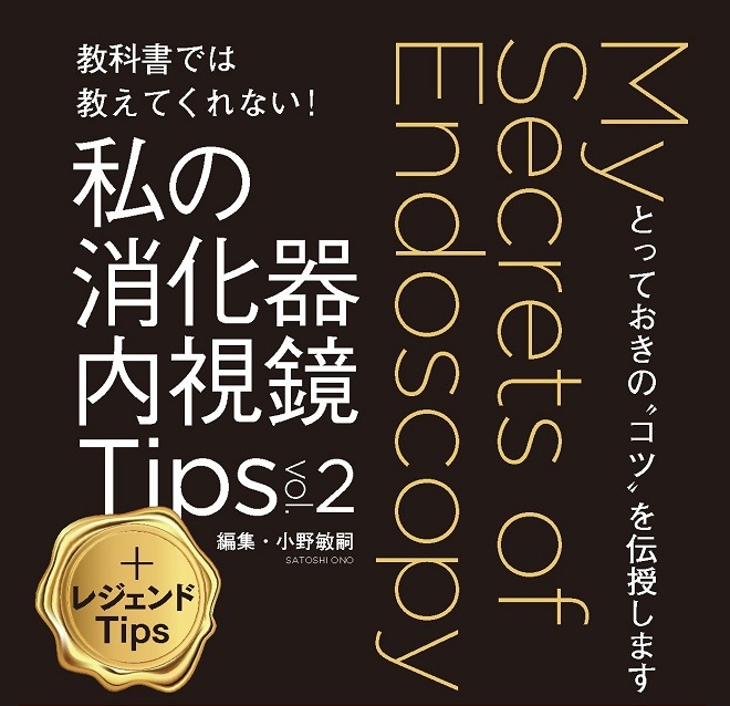 私の消化器内視鏡Tips vol.2