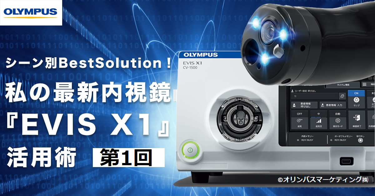 第1回　EVIS X1でのNBI拡大観察のコツ<br>～これから早期胃癌の拡大観察を始める先生方へ～　<br>五味 邦代（昭和大学藤が丘病院 消化器内科）