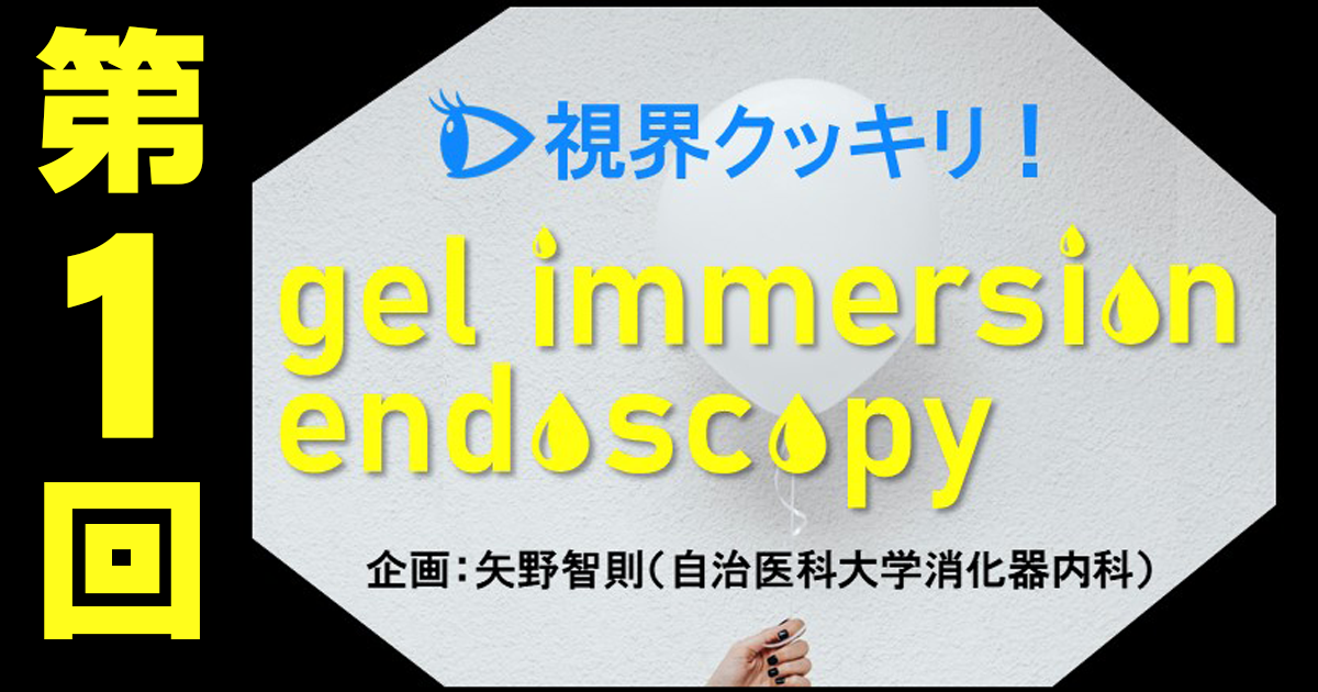 【第1回】なぜgel immersionが必要なのか？