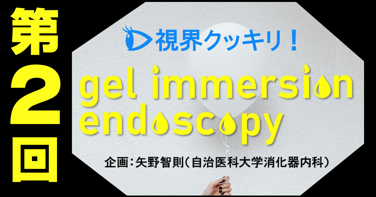 【第2回】gel immersion法を使いこなすコツ