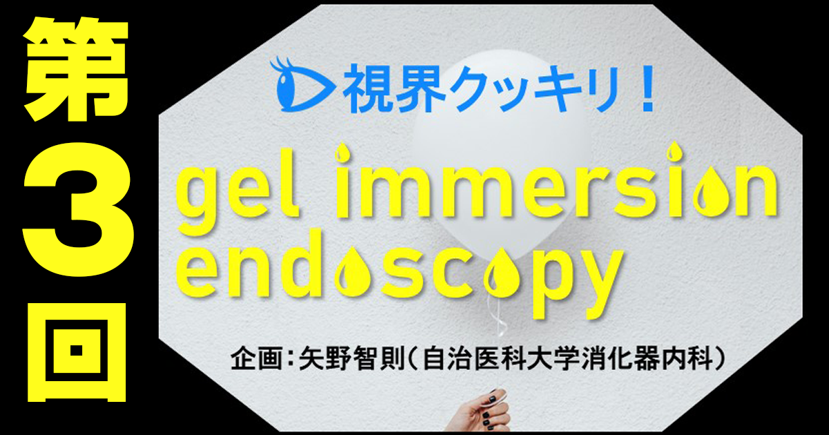 【第3回】食道ESDでの活用法―視野の確保に加え、冷却によるダブル効果も！