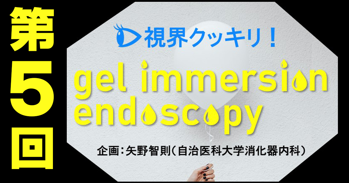 【第5回】胃でのgel immersion endoscopyの活用法―異物除去や胃軸捻転解除でも使える！