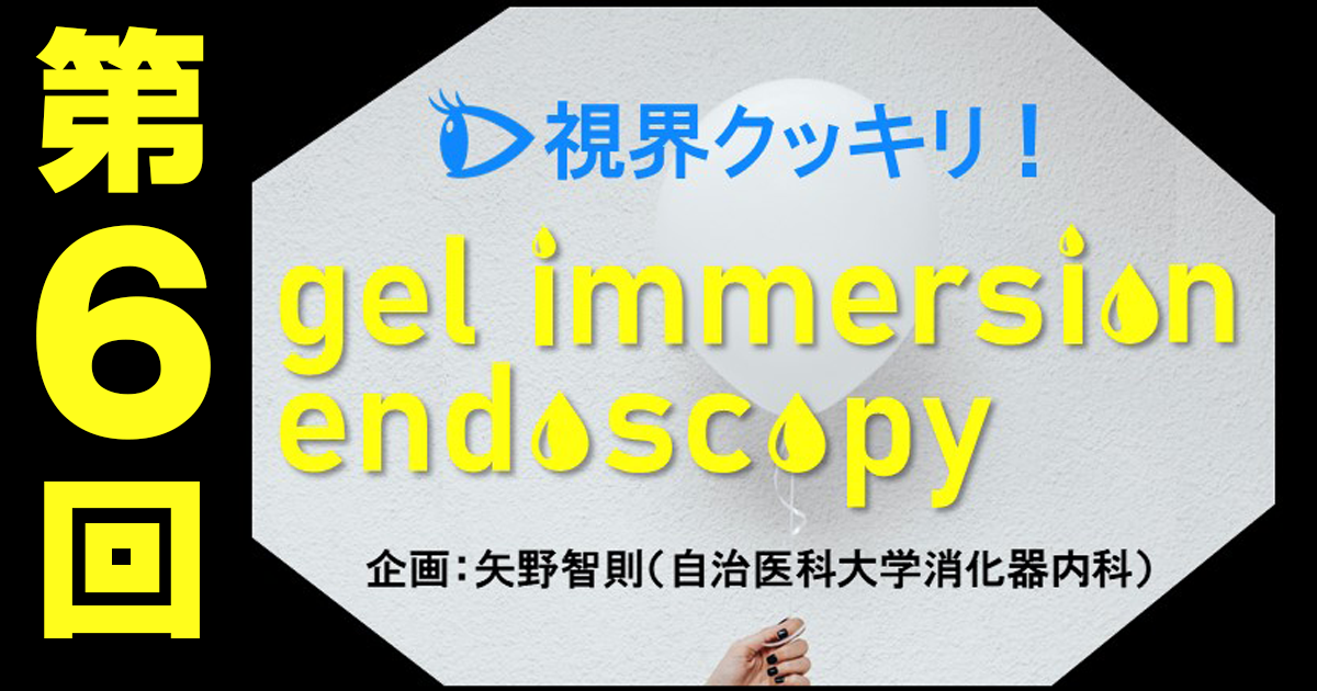 【第6回】胃ESDでのgel immersion endoscopyの活用法―既存のESDの欠点を補える！