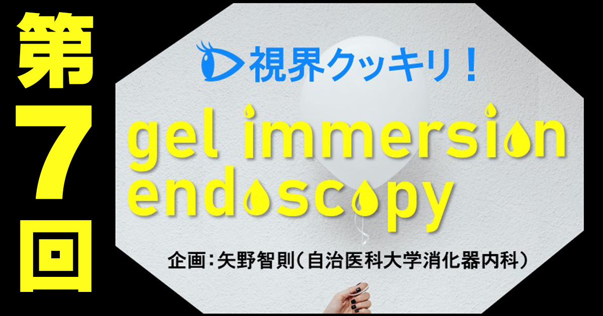 【第7回】十二指腸でのgel immersion endoscopyの活用法―EMR、止血、EUSなど、十二指腸でも大活躍！