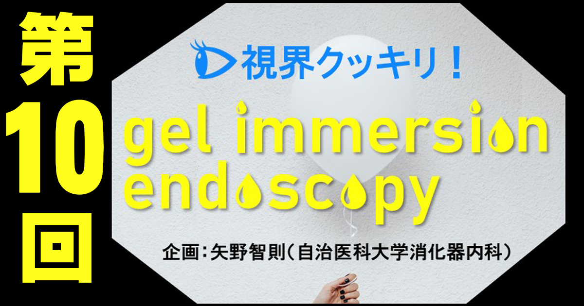 【第10回・最終回】大腸でのgel immersion endoscopyの活用法―出血源同定やステント留置、軸捻転解除など！