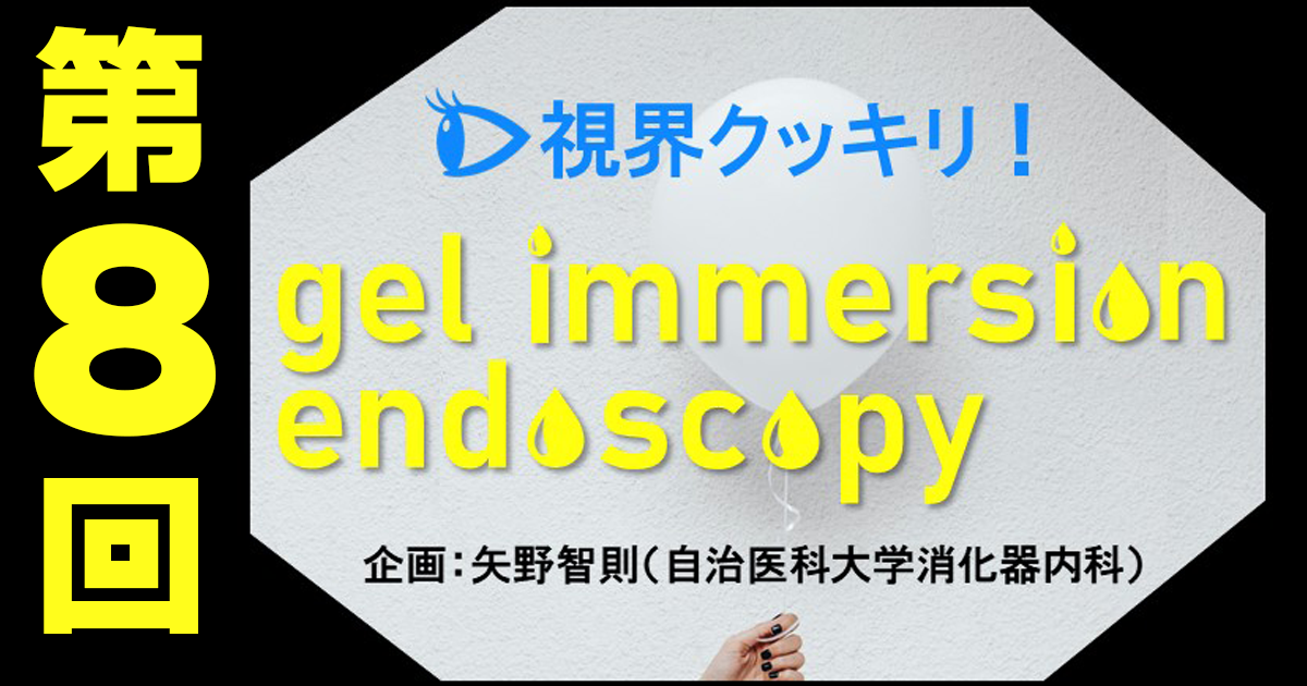 【第8回】胆膵領域におけるgel immersion method―EUSや内視鏡的乳頭切除でも！