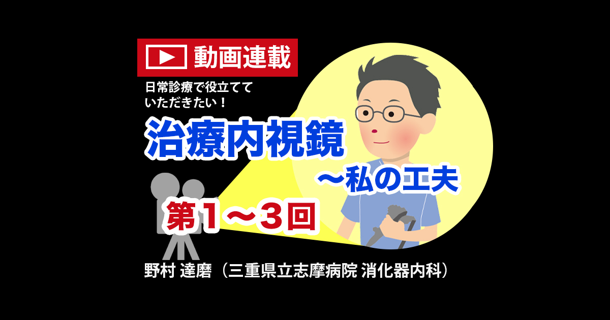 第1～3回　偶発症低減のための新規ESD後粘膜欠損閉鎖法の考案　<br>野村達磨（三重県立志摩病院 消化器内科）