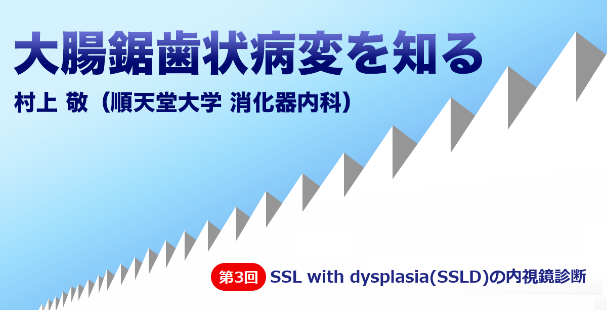第3回 SSL with dysplasia(SSLD)の内視鏡診断　村上 敬（順天堂大学 消化器内科）