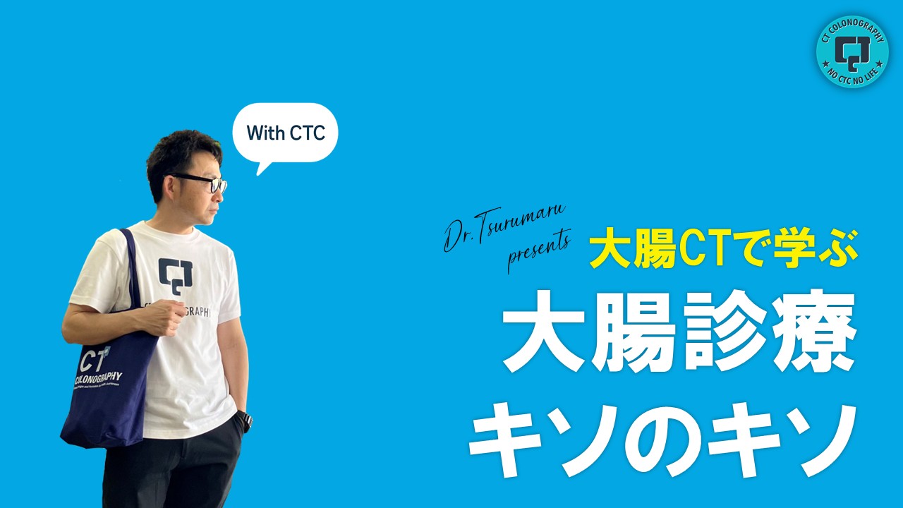 1．大腸CTとはどんな検査？大腸内視鏡との違いは？