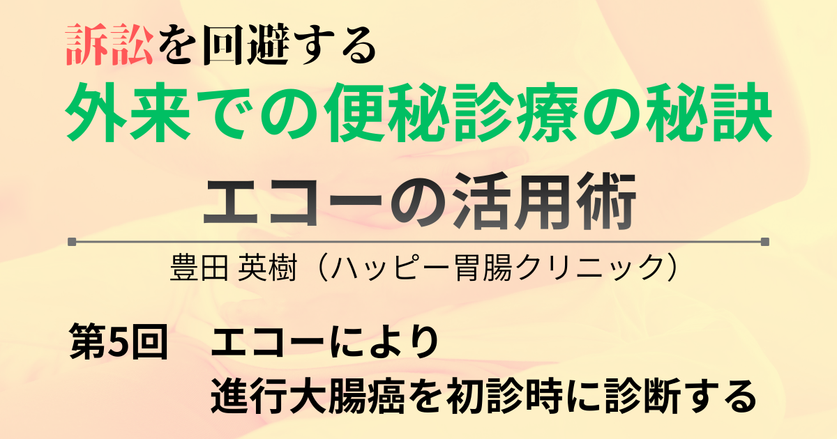 第5回　エコーにより進行大腸癌を初診時に診断する