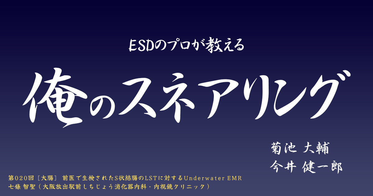 ESDのプロが教える「俺のスネアリング」　<br>第020回 [大腸] 前医で生検されたS状結腸のLSTに対するUnderwater EMR　<br>七條 智聖（大阪放出駅前しちじょう消化器内科・内視鏡クリニック）