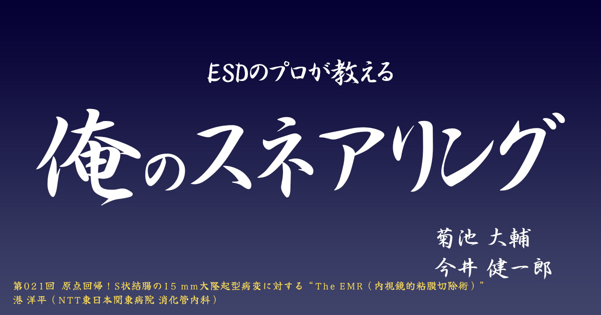 ESDのプロが教える「俺のスネアリング」 <br>第021回［大腸］原点回帰！S状結腸の15 mm大隆起型病変に対する “The EMR（内視鏡的粘膜切除術）”<br>港 洋平（NTT東日本関東病院 消化管内科）