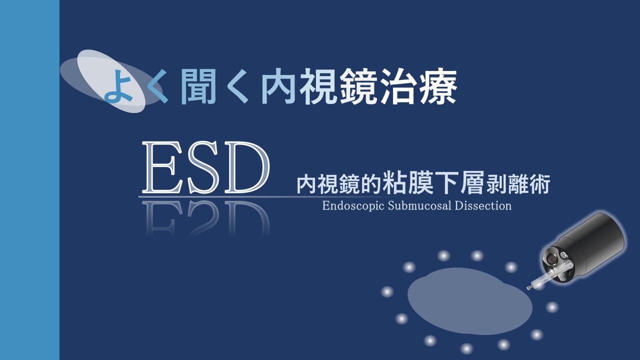 #9 よく聞く内視鏡治療～ESD～