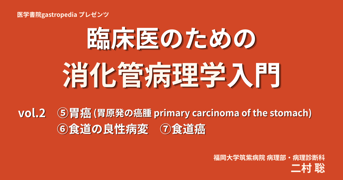 [有料動画コンテンツ]　臨床医のための消化管病理学入門　vol.2　⑤胃癌 (胃原発の癌腫 primary carcinoma of the stomach)／⑥食道の良性病変／⑦食道癌　二村 聡（福岡大学筑紫病院病理部・病理診断科）（GAS20260716-2）