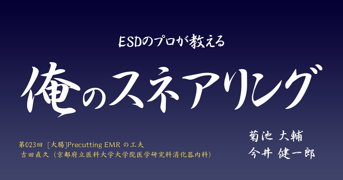ESDのプロが教える「俺のスネアリング」　第023回 [大腸]Precutting EMRの工夫　吉田直久（京都府立医科大学大学院医学研究科消化器内科）