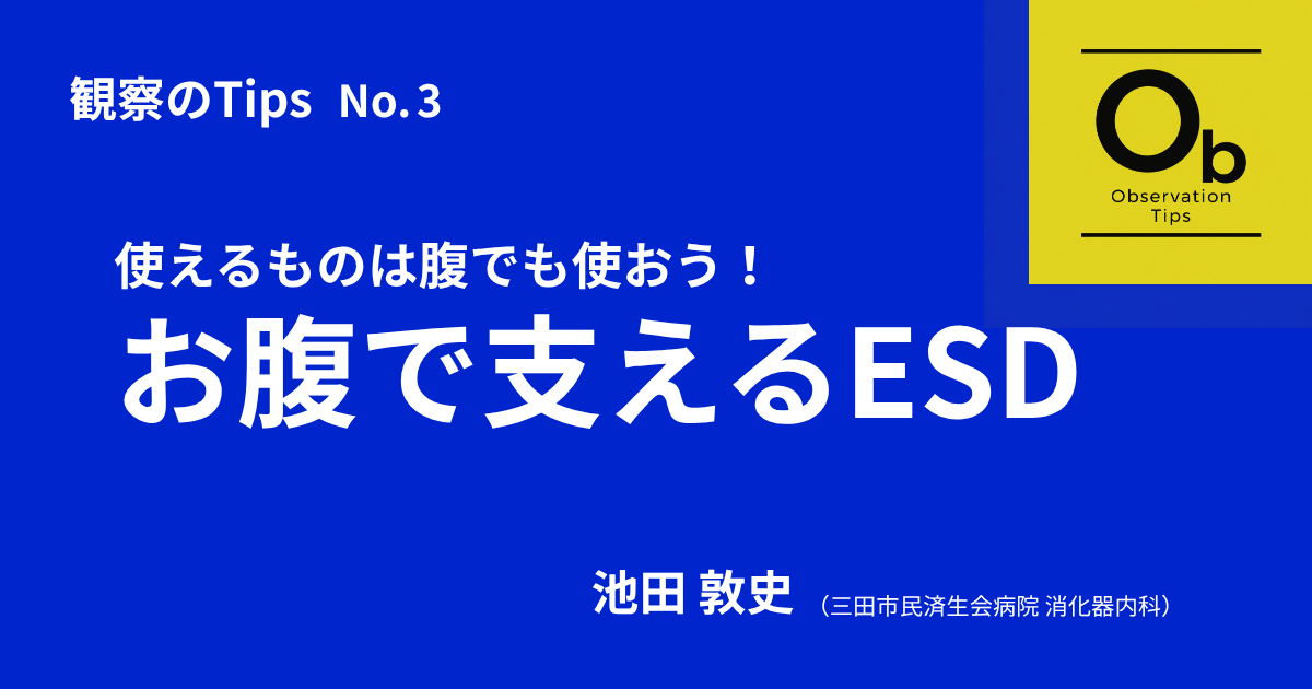 Ob_03　使えるものは腹でも使おう！お腹で支えるESD<BR>　池田 敦史（三田市民済生会病院 消化器内科）