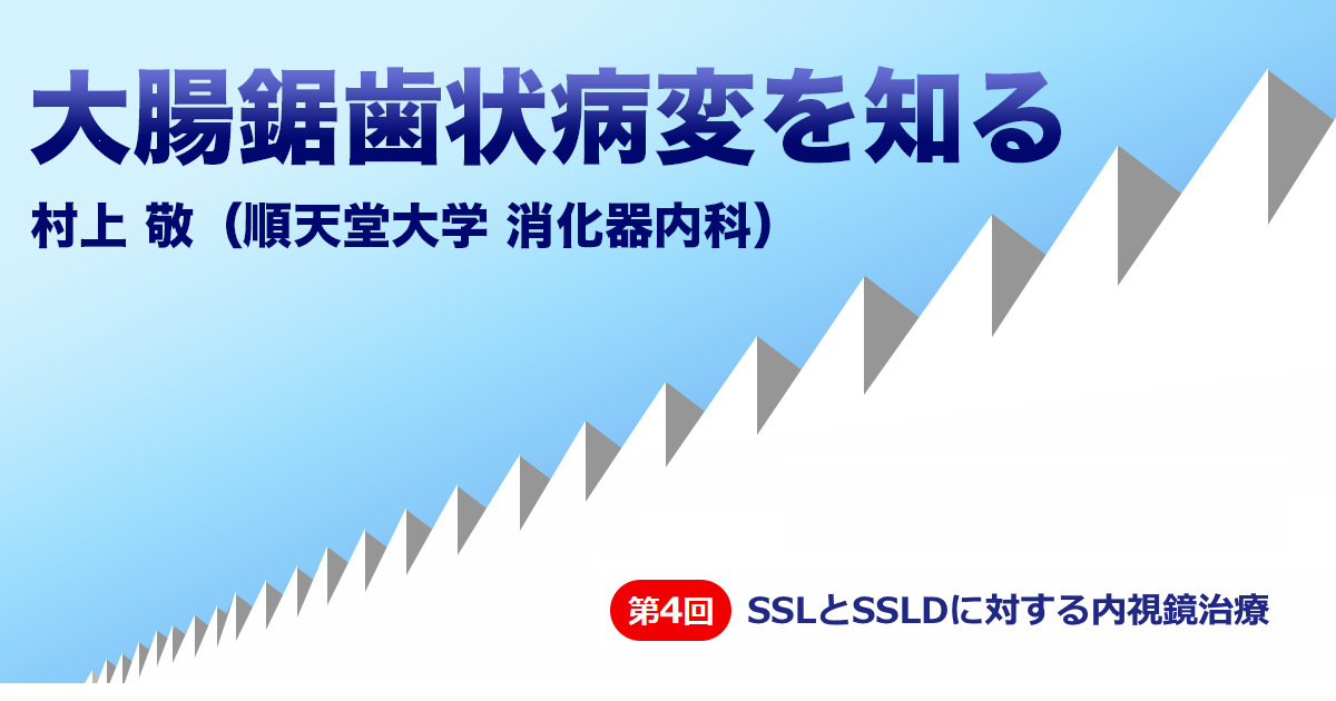 第4回 SSLとSSLDに対する内視鏡治療　村上 敬（順天堂大学 消化器内科）