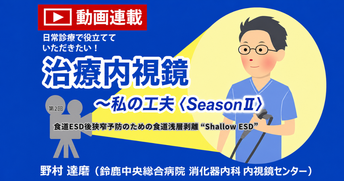 第2回　食道ESD後狭窄予防のための食道浅層剥離 “Shallow ESD”　<br>野村達磨（鈴鹿中央総合病院消化器内科 内視鏡センター）