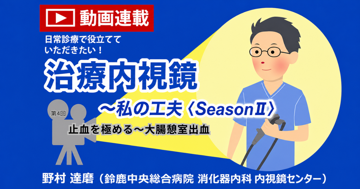 第4回　止血を極める～大腸憩室出血 　野村 達磨（鈴鹿中央総合病院 消化器内科 内視鏡センター）