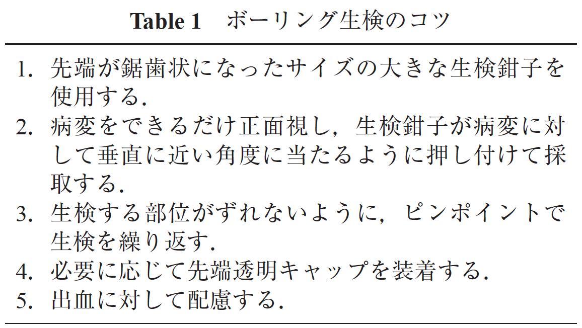 Table 1　ボーリング生検のコツ