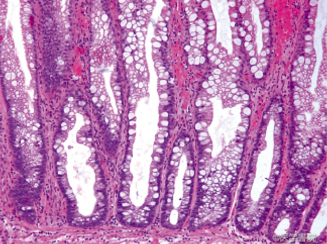 Fig. 1b 　大腸鋸歯状病変の病理組織像．hyperplastic polyp（強拡大）．