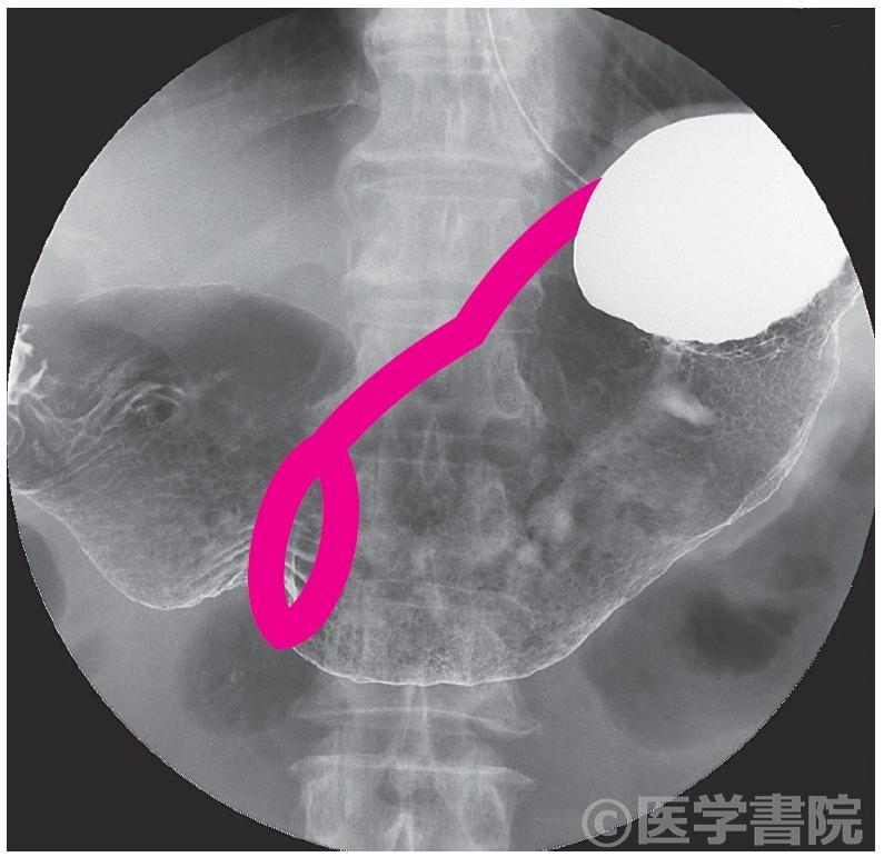 Fig. 6a　胃の中軸をなす筋層構造． 
