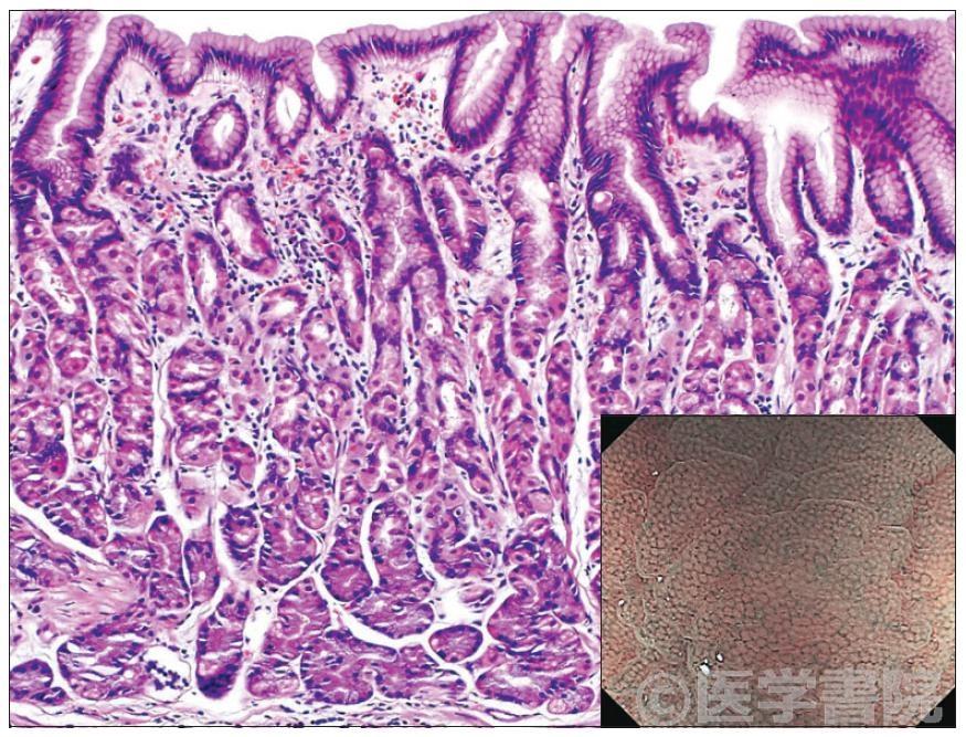 Fig. 3　胃底腺組織像とNBI 拡大像．