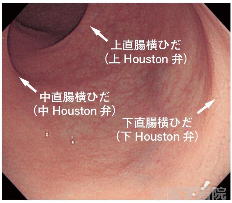Fig. 7　直腸の内視鏡像．
