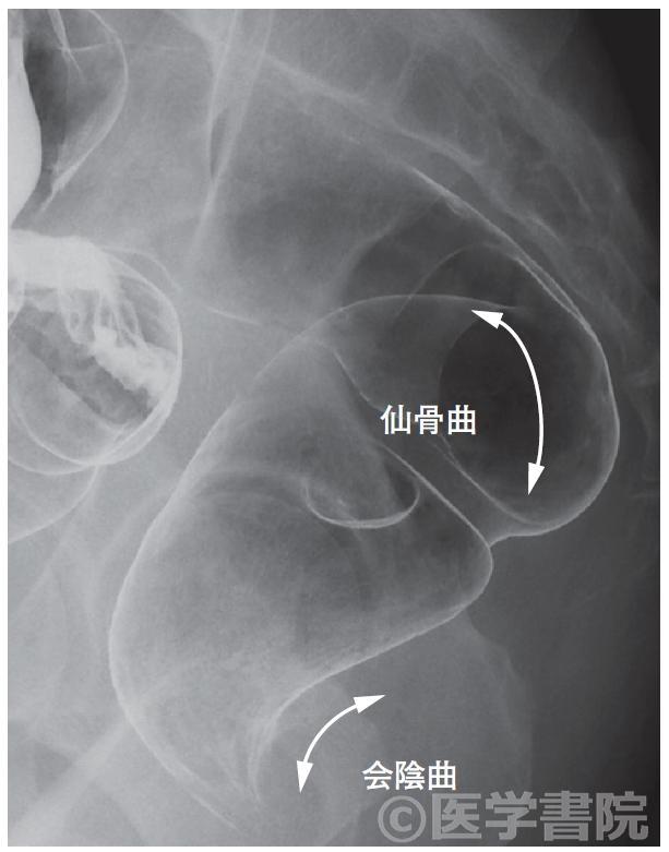 Fig. 6　直腸の側面像．