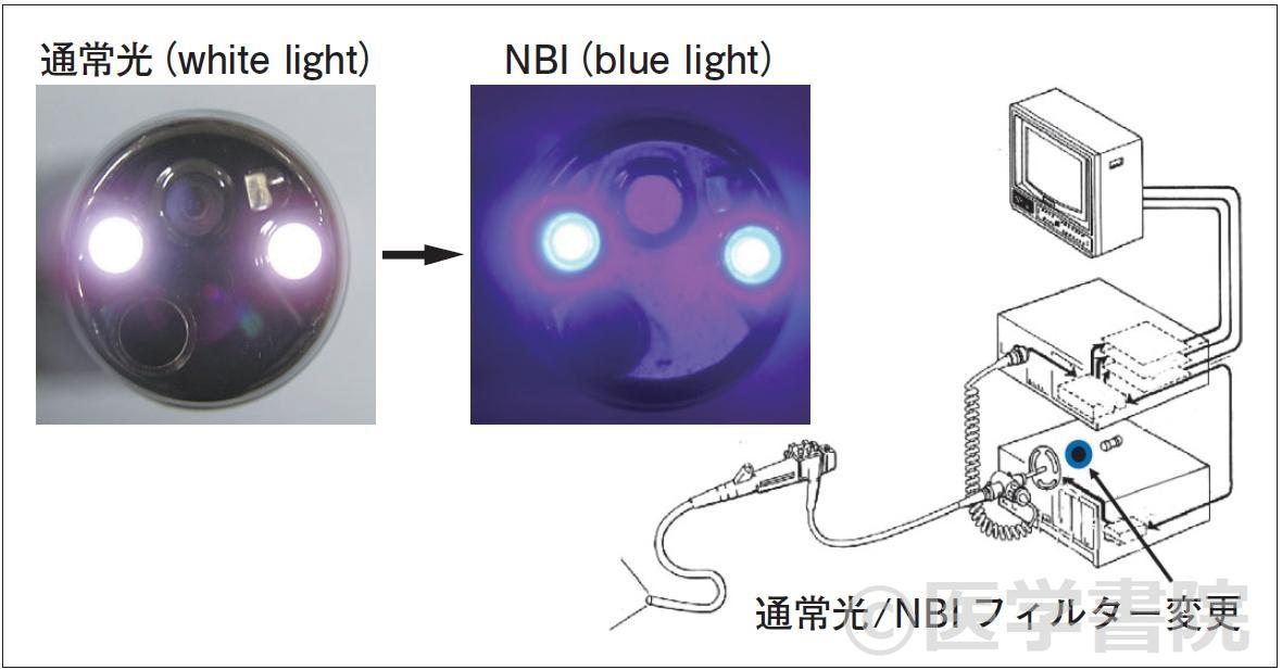 Fig. 2　NBI システムのフィルター装置と実際の照明光．内視鏡手元のスイッチを操作することで，光源前面にフィルターが着脱されることによりNBI 観察が可能となる．実際の内視鏡先端から発する光はwhite light からblue light に変化する．